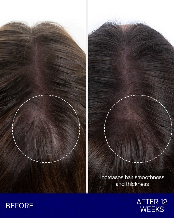 Augustinus Bader* The Hair Oil Augustinus Bader* The Hair Oil - Image 4