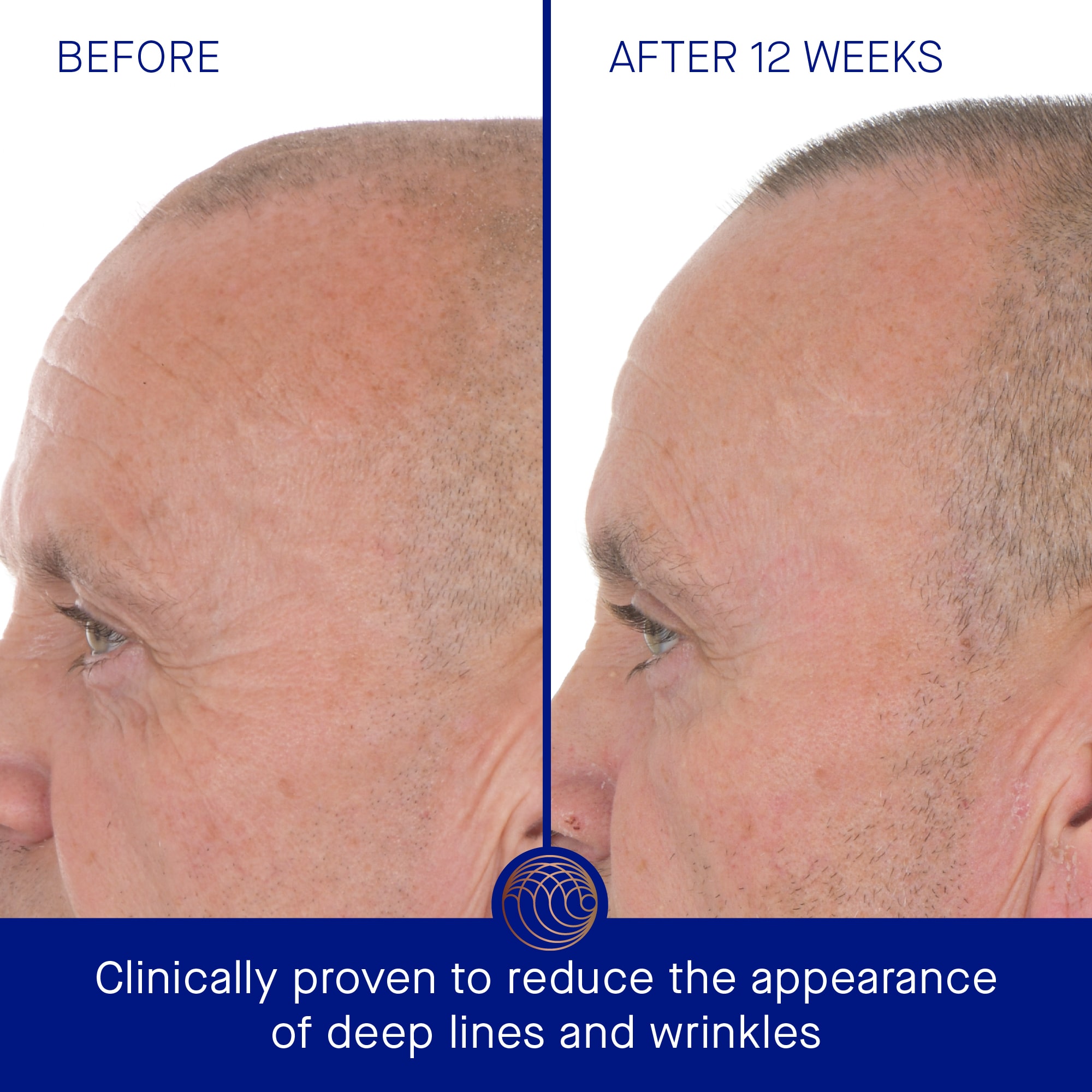 Augustinus Bader* The Retinol Serum Augustinus Bader* The Retinol Serum - Image 8